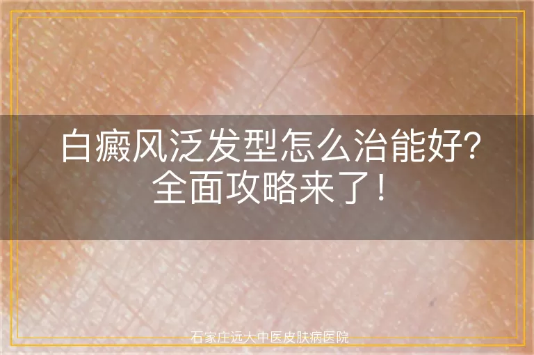 白癜风泛发型怎么治能好？全面攻略来了！