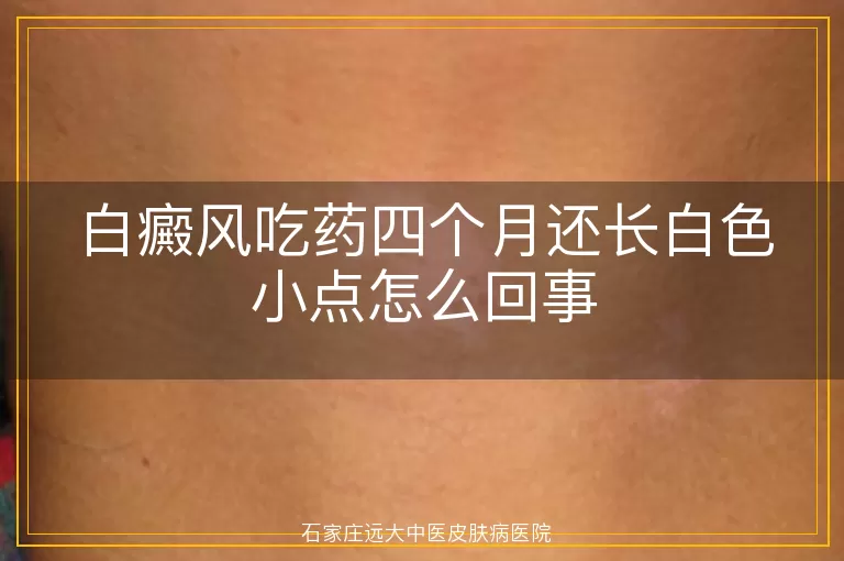 白癜风吃药四个月还长白色小点怎么回事