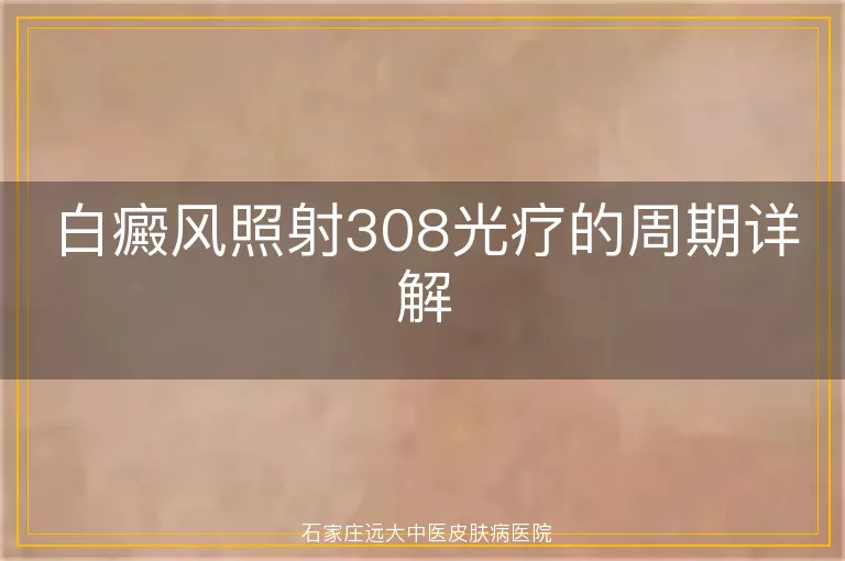 白癜风照射308光疗的周期详解