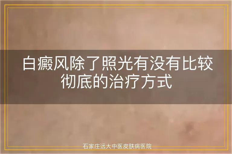 白癜风除了照光有没有比较彻底的治疗方式