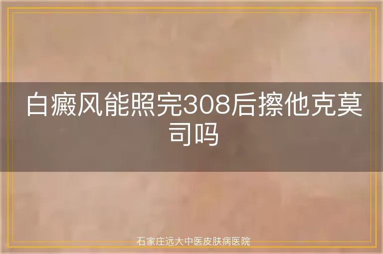 白癜风能照完308后擦他克莫司吗