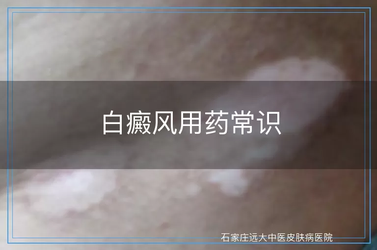 白癜风用药常识
