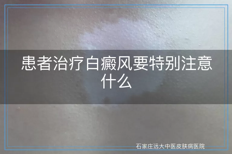 患者治疗白癜风要特别注意什么