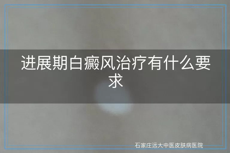 进展期白癜风治疗有什么要求