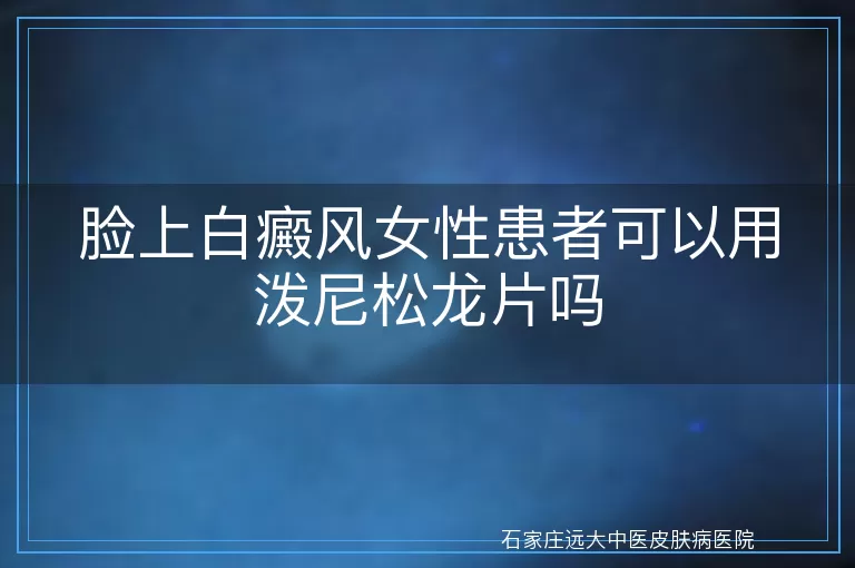 脸上白癜风女性患者可以用泼尼松龙片吗