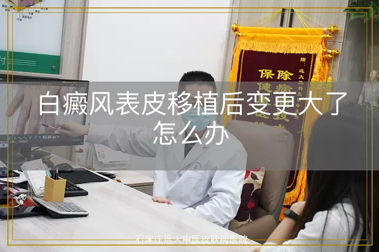 白癜风表皮移植后变更大了怎么办