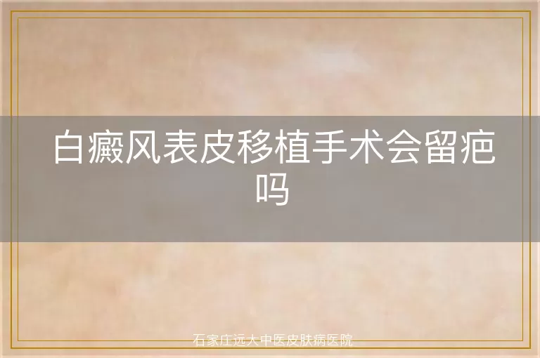 白癜风表皮移植手术会留疤吗