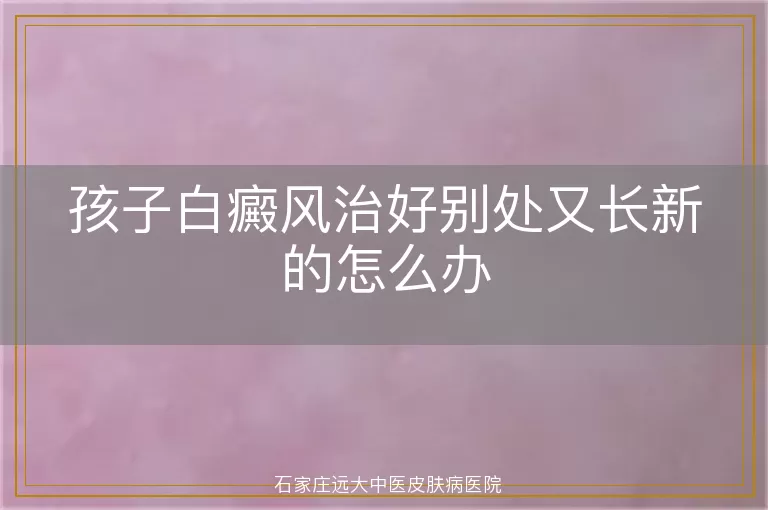 孩子白癜风治好别处又长新的怎么办