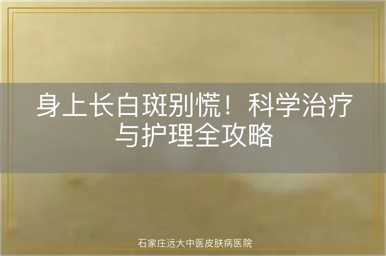 身上长白斑别慌!科学治疗与护理全攻略