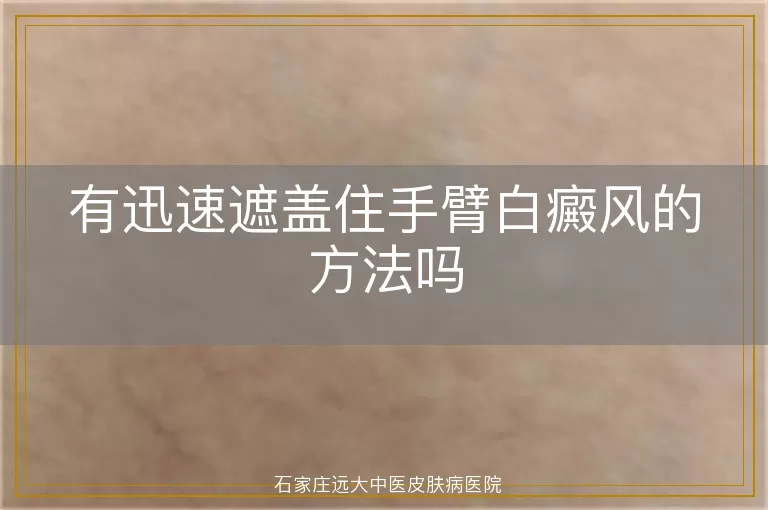 有迅速遮盖住手臂白癜风的方法吗