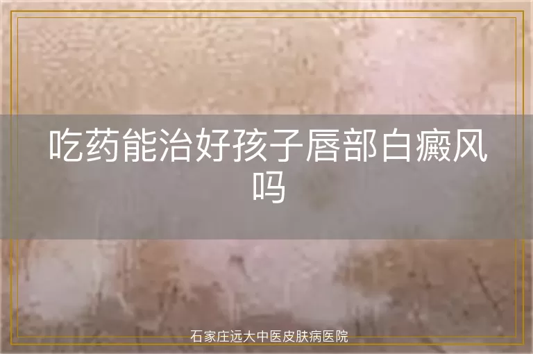 吃药能治好孩子唇部白癜风吗