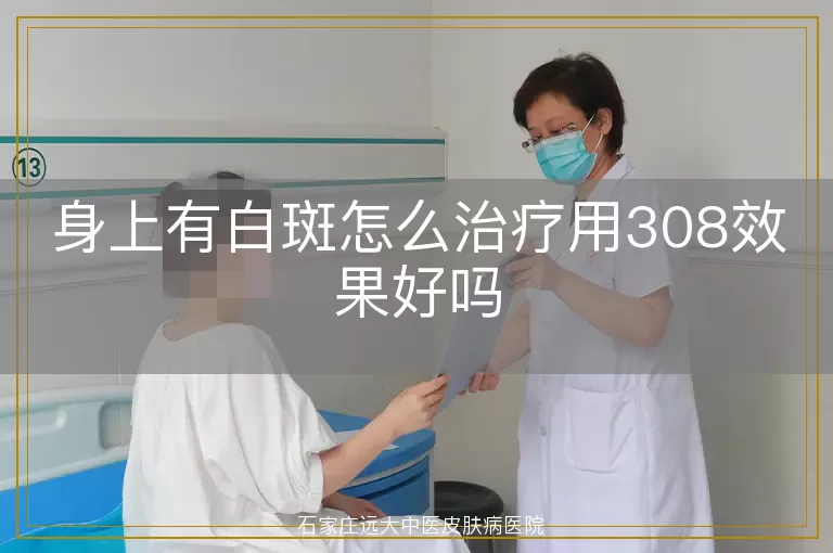 身上有白斑怎么治疗用308效果好吗