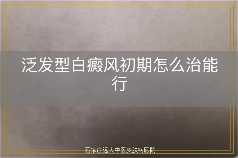 泛发型白癜风初期怎么治能行