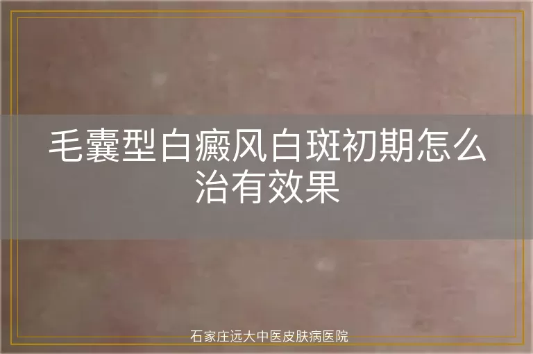 毛囊型白癜风白斑初期怎么治有效果