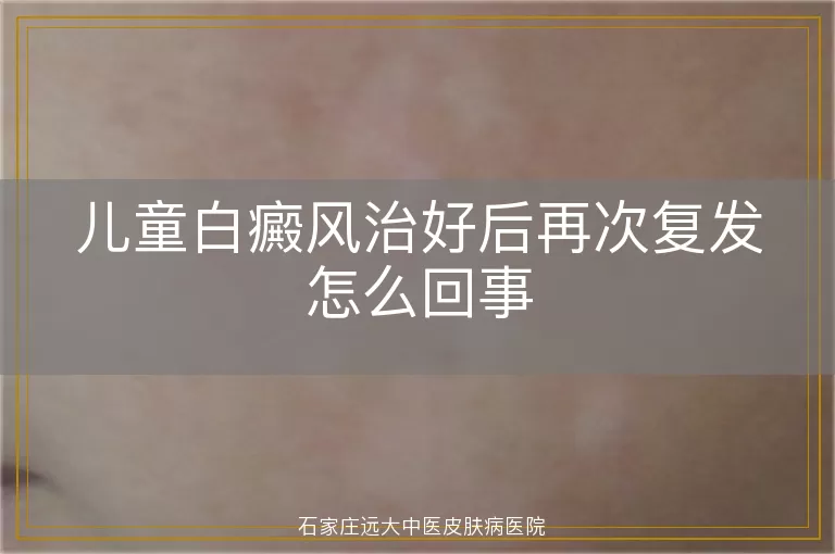 儿童白癜风治好后再次复发怎么回事