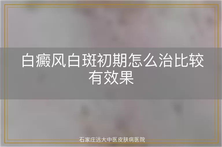 白癜风白斑初期怎么治比较有效果