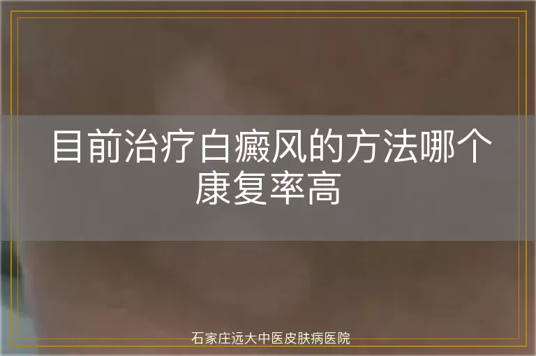 目前治疗白癜风的方法哪个康复率高