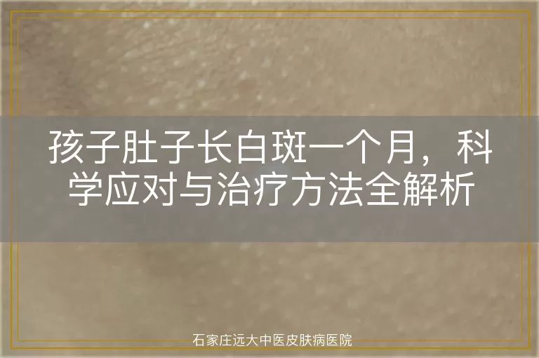孩子肚子长白斑一个月，科学应对与治疗方法全解析