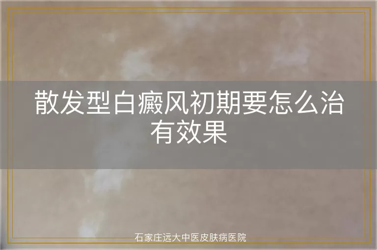 散发型白癜风初期要怎么治有效果