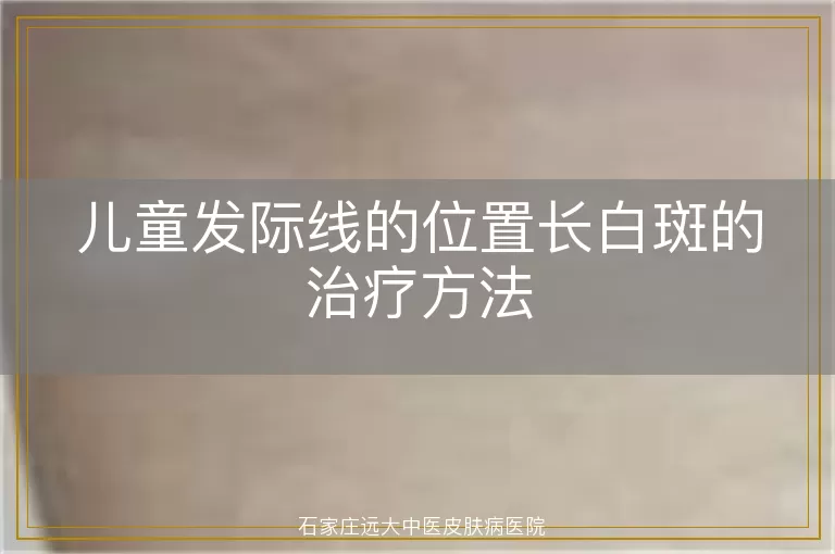 儿童发际线的位置长白斑的治疗方法