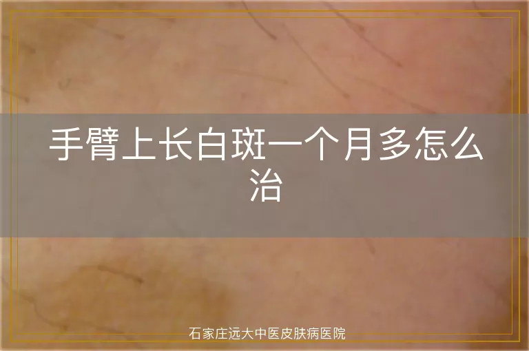 手臂上长白斑一个月多怎么治