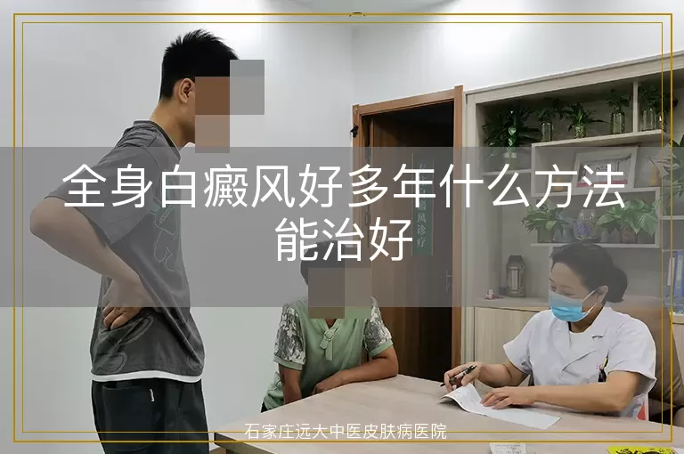 全身白癜风好多年什么方法能治好