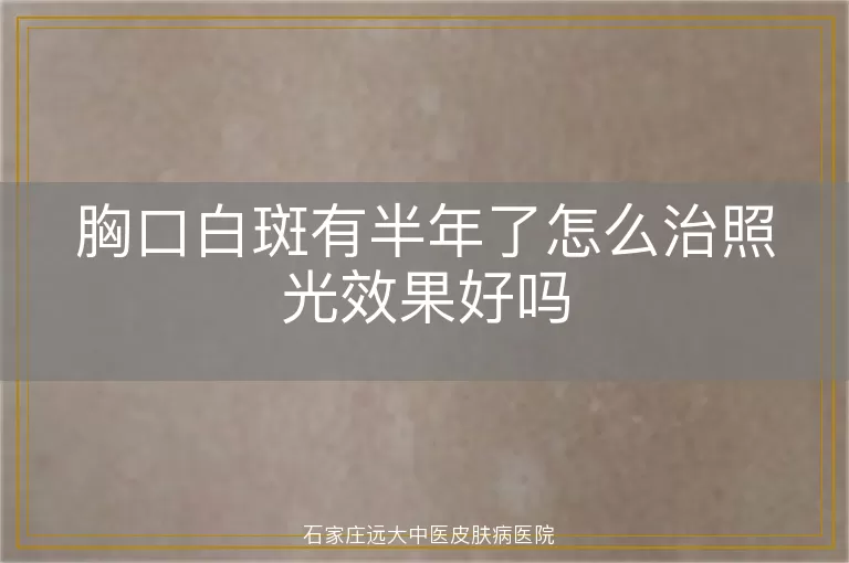 胸口白斑有半年了怎么治照光效果好吗