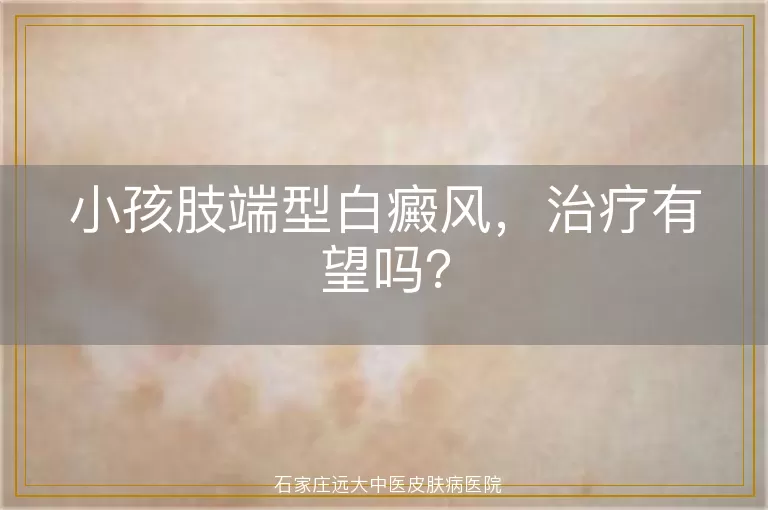 小孩肢端型白癜风，治疗有望吗？