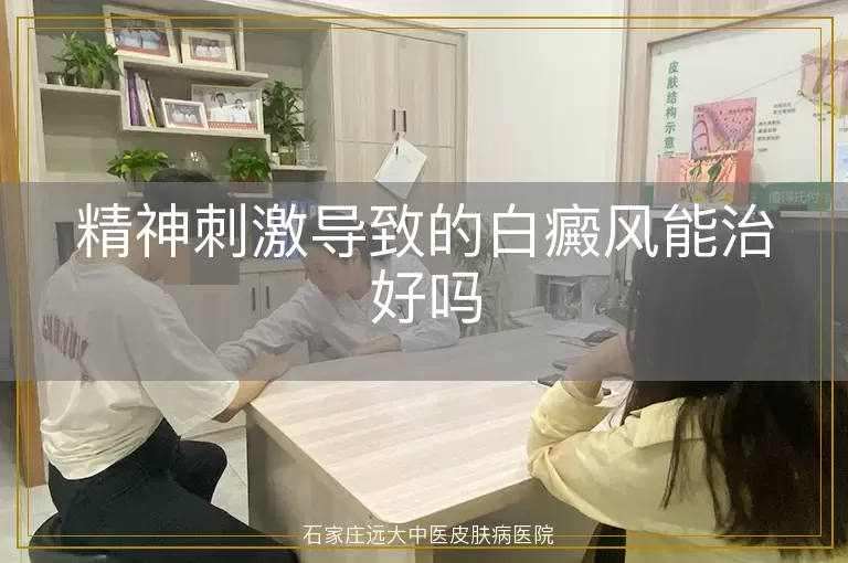 精神刺激导致的白癜风能治好吗