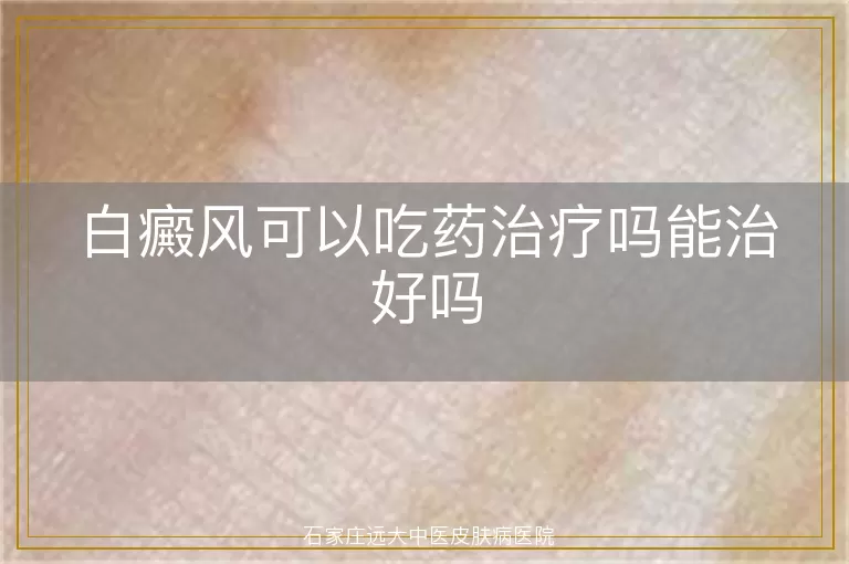 白癜风可以吃药治疗吗能治好吗
