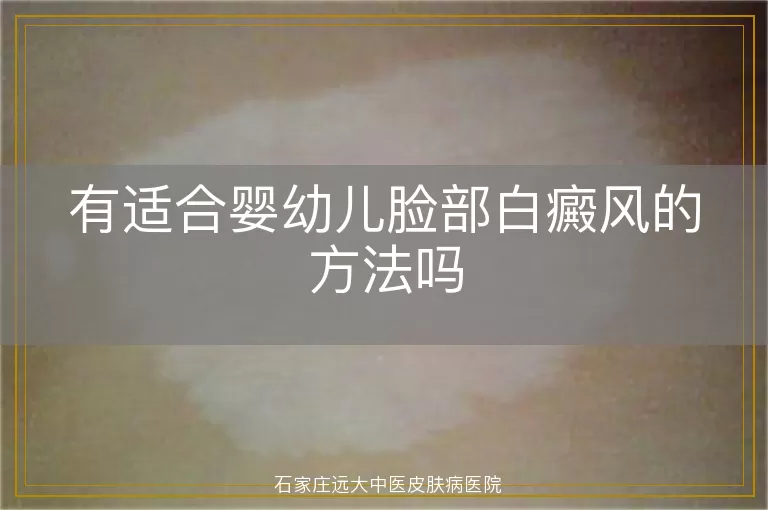 有适合婴幼儿脸部白癜风的方法吗