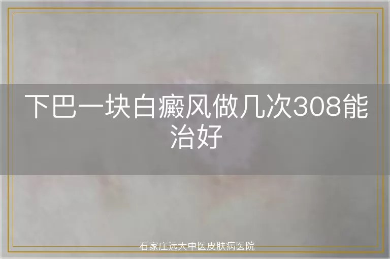 下巴一块白癜风做几次308能治好