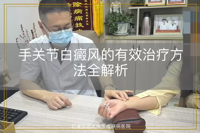 手关节白癜风的有效治疗方法全解析