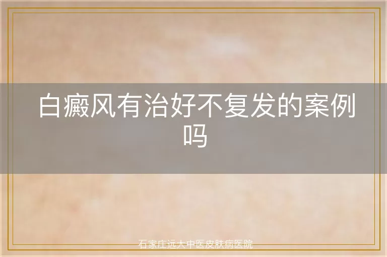 白癜风有治好不复发的案例吗