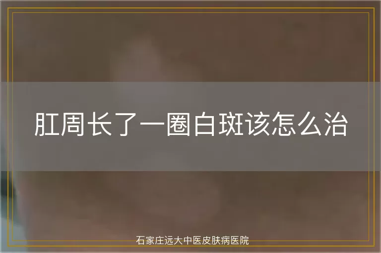 肛周长了一圈白斑该怎么治