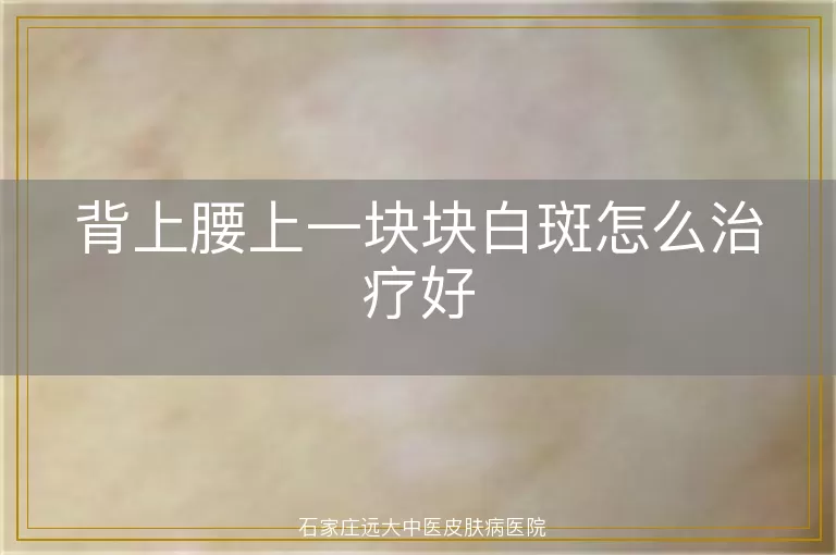 背上腰上一块块白斑怎么治疗好