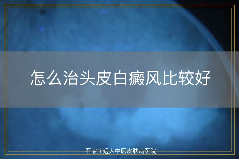 怎么治头皮白癜风比较好