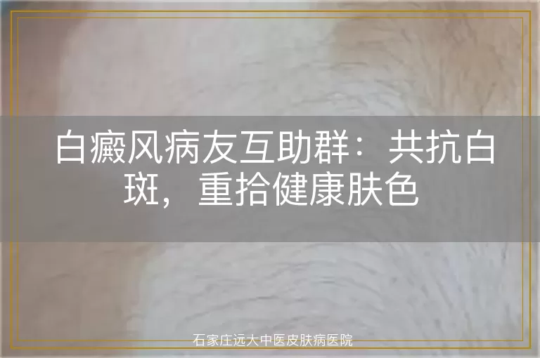 白癜风病友互助群：共抗白斑，重拾健康肤色