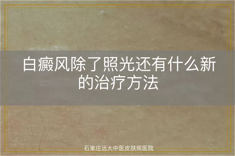 白癜风除了照光还有什么新的治疗方法