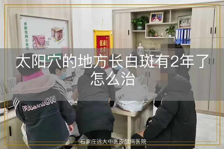 太阳穴的地方长白斑有2年了怎么治