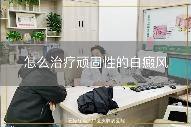怎么治疗顽固性的白癜风