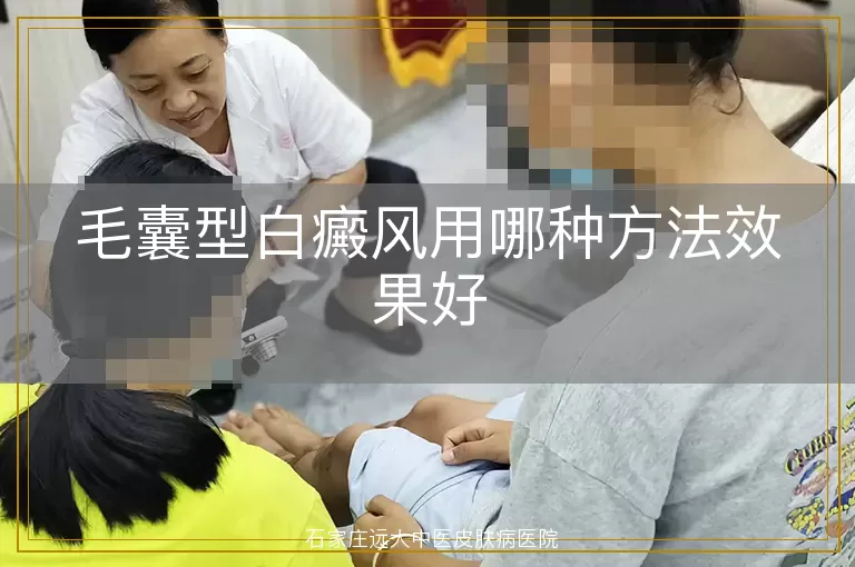 毛囊型白癜风用哪种方法效果好