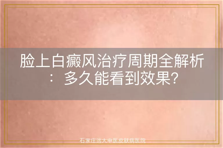脸上白癜风治疗周期全解析：多久能看到效果？