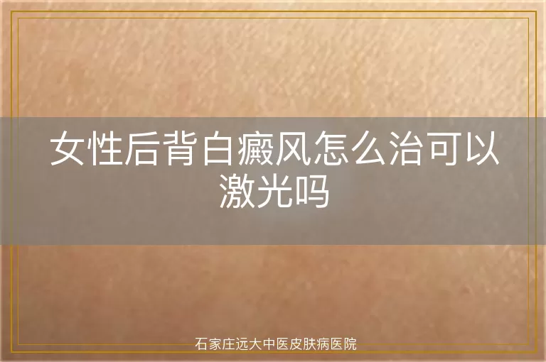 女性后背白癜风怎么治可以激光吗