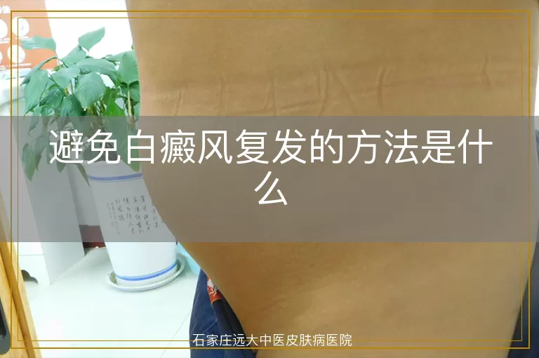 避免白癜风复发的方法是什么