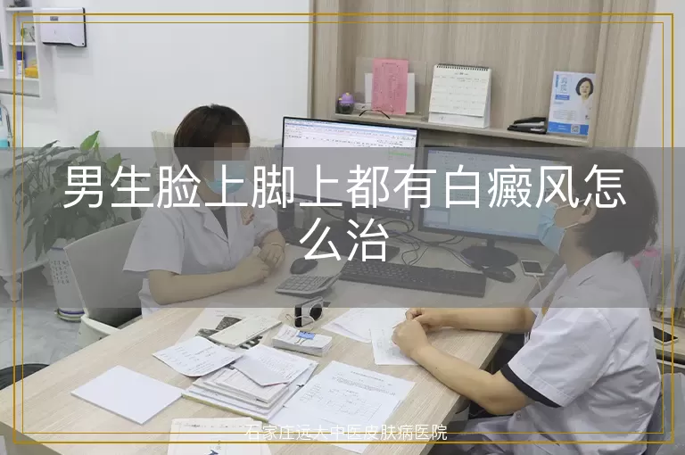 男生脸上脚上都有白癜风怎么治