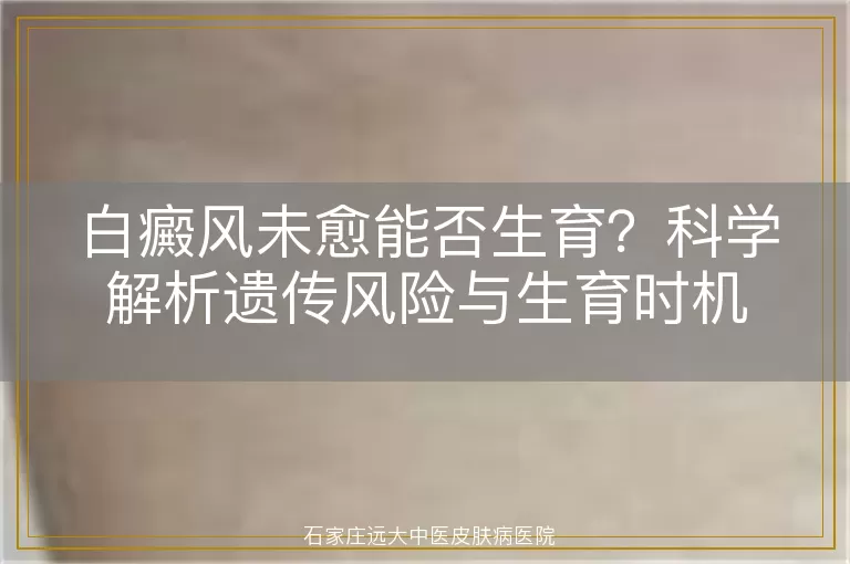 白癜风未愈能否生育？科学解析遗传风险与生育时机