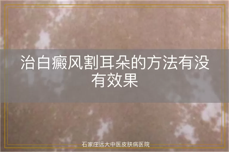 治白癜风割耳朵的方法有没有效果