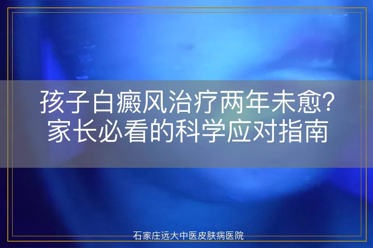 孩子白癜风治疗两年未愈?家长必看的科学应对指南