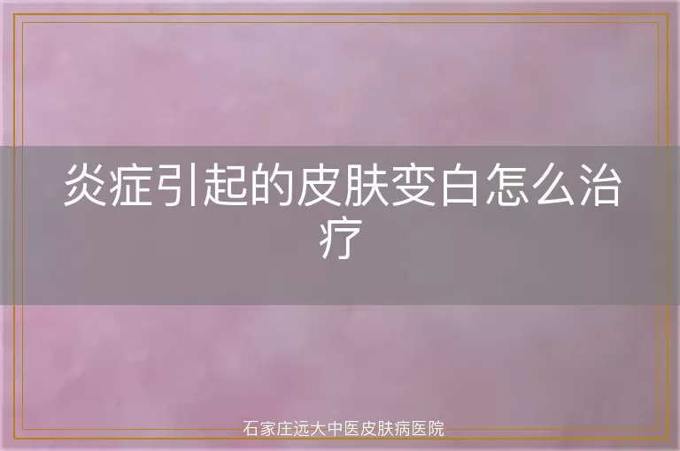 炎症引起的皮肤变白怎么治疗